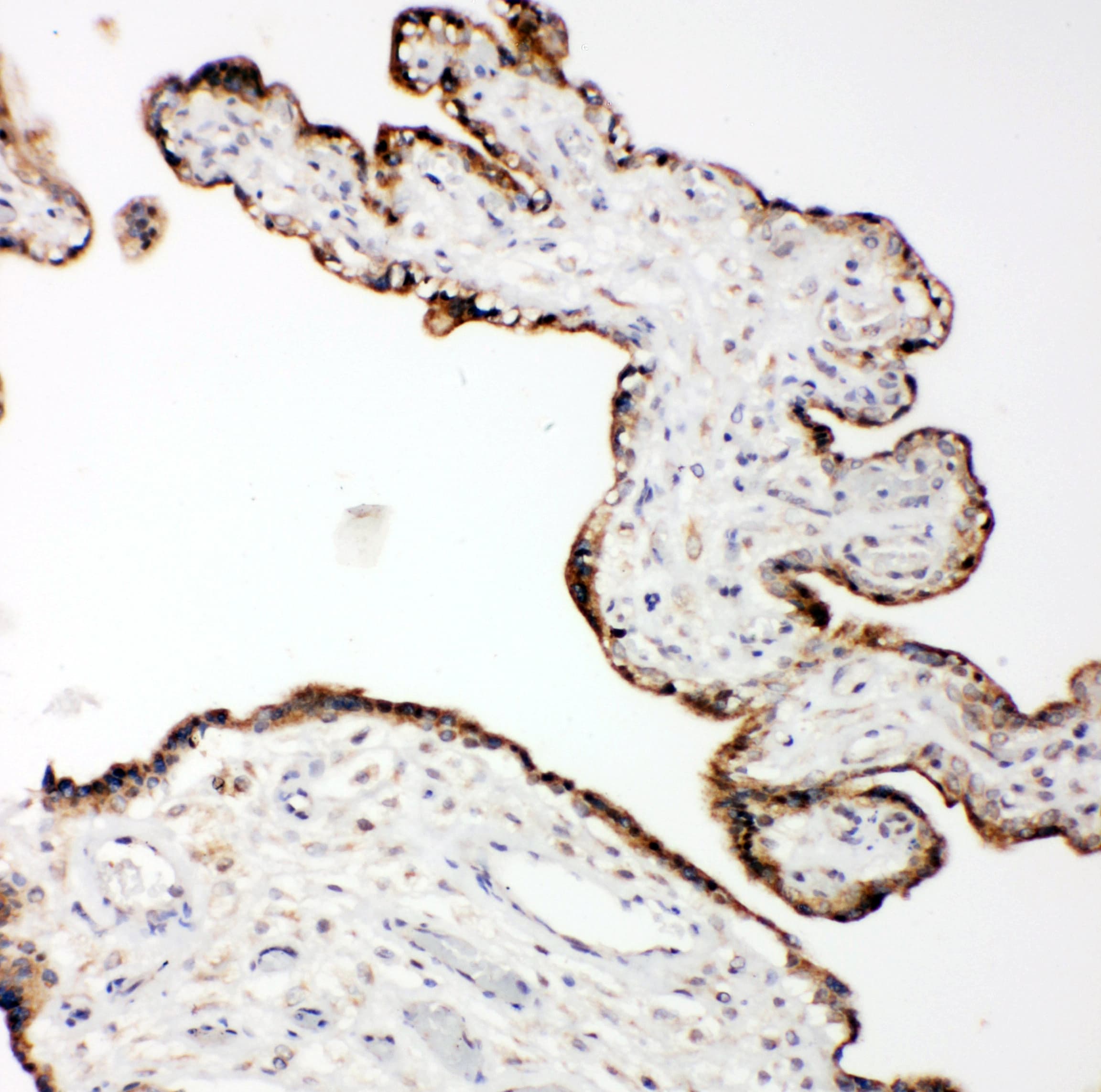MMP14 Antibody (aa567-582)