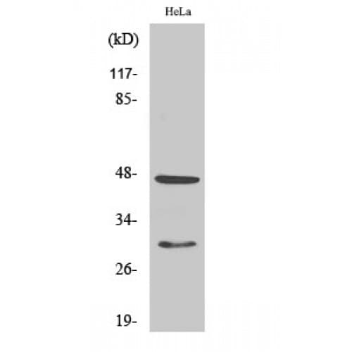 CTSD / Cathepsin D Antibody (Internal)