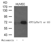 Polyclonal Rabbit anti-Human ATF2 Antibody (IHC, WB)