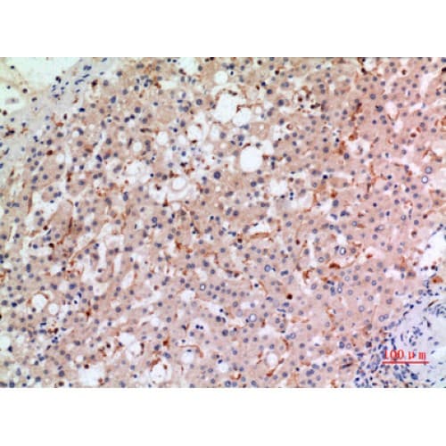 Polyclonal Rabbit anti-Human CYBB / NOX2 / gp91phox Antibody (Internal, IHC, WB)