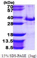 Human TOLLIP Protein (Recombinant His)