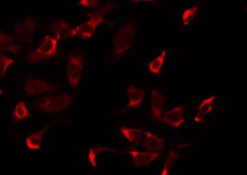 MRPS2 Antibody