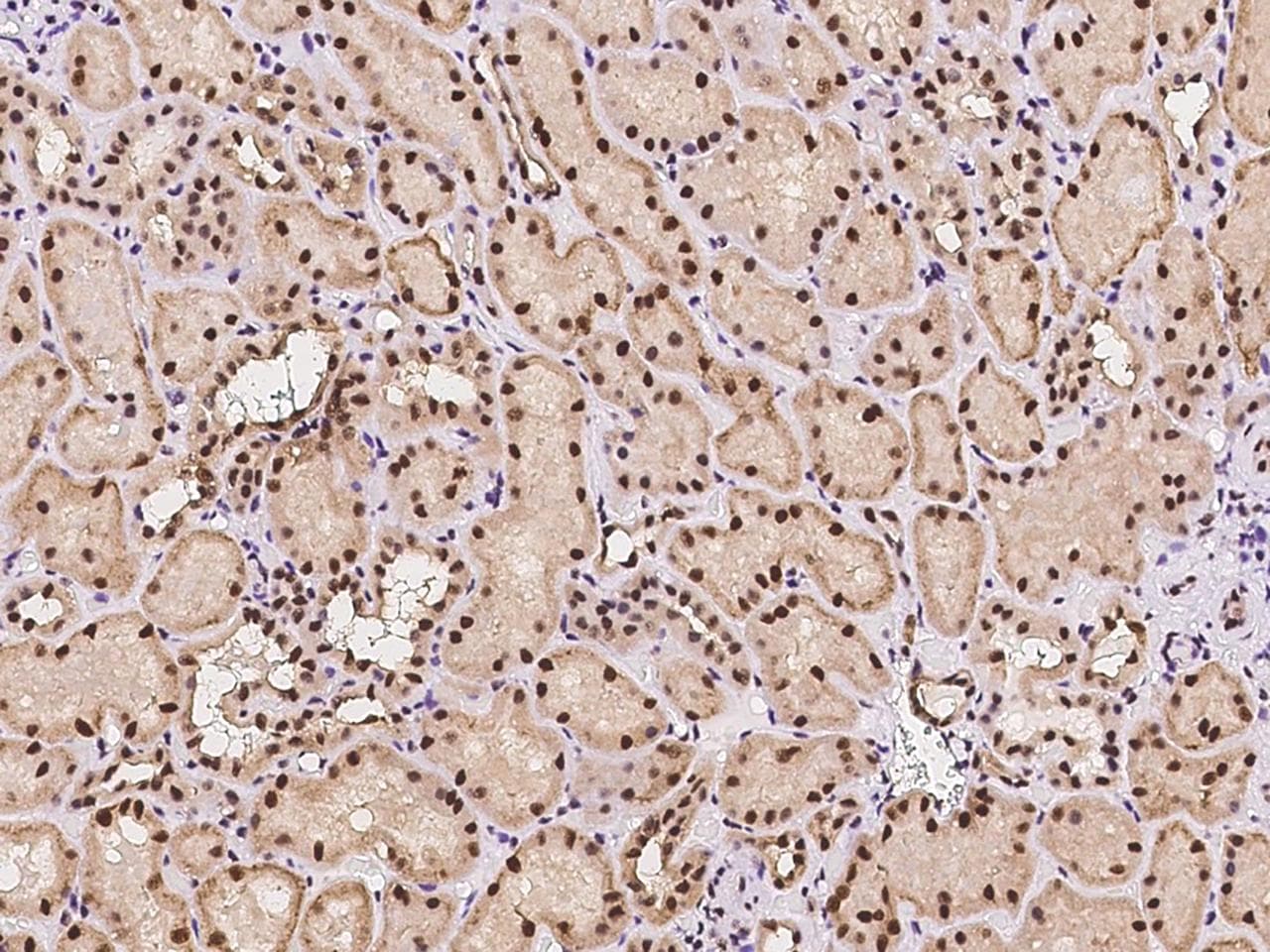 HEXIM1 Antibody