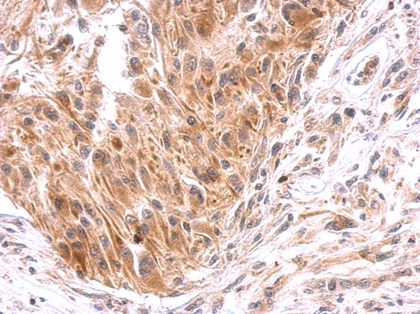 Polyclonal Rabbit anti-Human EPS8 Antibody (aa761-822, IHC, WB)