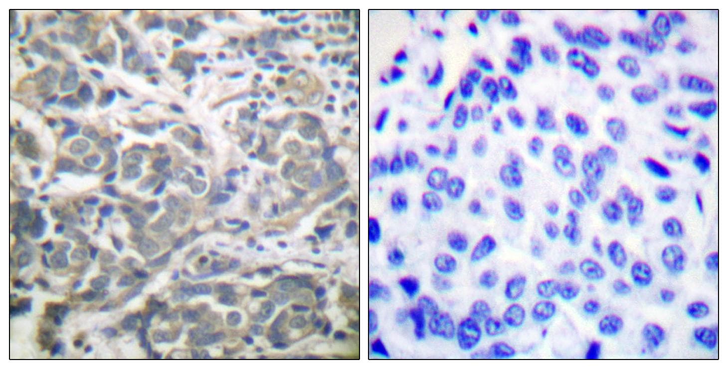 PRKAA1 / AMPK Alpha 1 Antibody (p172)