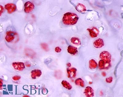 PathPlus™ Polyclonal Rabbit anti-Human ADAMTS4 Antibody (Disintegrin-like Domain, IHC)