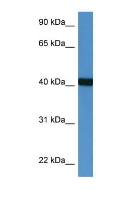 Polyclonal Rabbit anti-Human PTER Antibody (aa63-112, WB)
