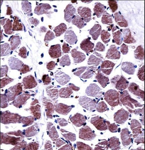 Polyclonal Rabbit anti-Human STEAP1 / STEAP Antibody (aa2-31, IHC, WB)