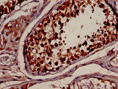 14-3-3 Alpha + Beta Antibody