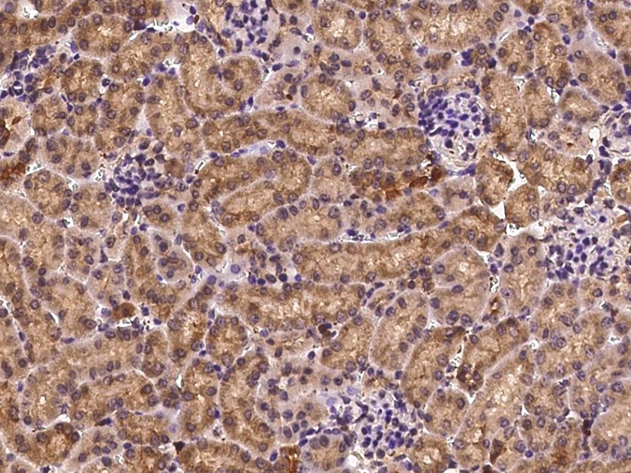 PFN1 / Profilin 1 Antibody