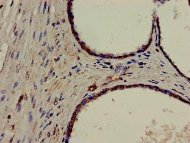 ERCC4 / XPF Antibody