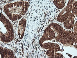MSI2 Antibody (clone OTI2F10)