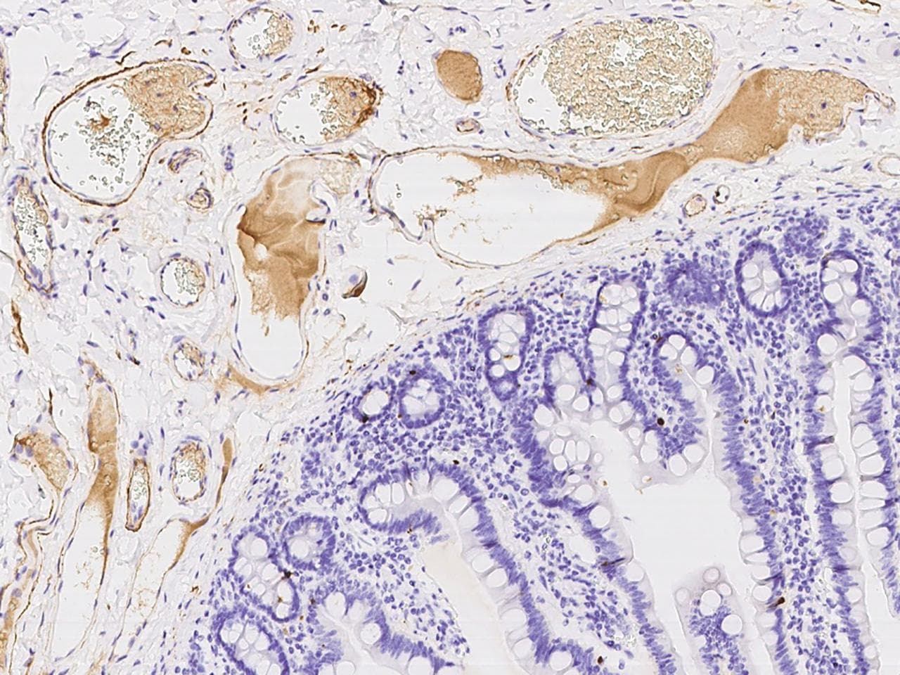 VTN / Vitronectin Antibody