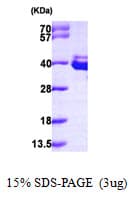 Human ANXA8 / Annexin A8 Protein (Recombinant His)