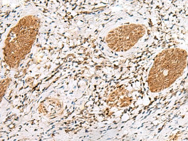 Polyclonal Rabbit anti-Human NUPL1 Antibody (IHC)