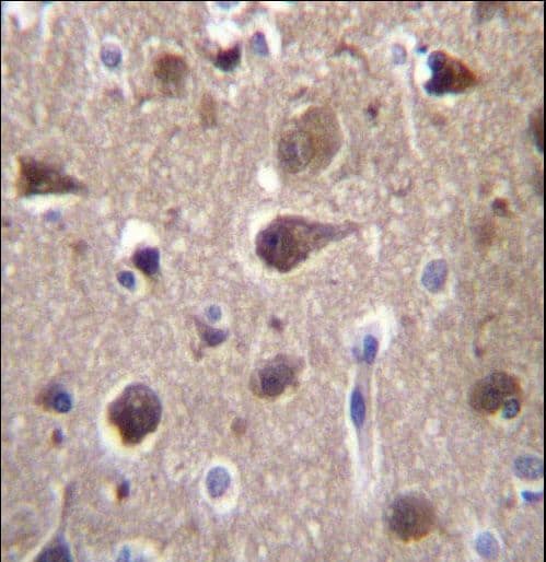Polyclonal Rabbit anti-Human MRAP2 Antibody (aa58-86, IHC, WB)