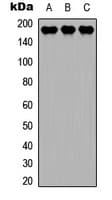 MAP3K4 / MEKK4 Antibody (C-Terminus)
