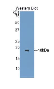 HPSE / Heparanase Antibody (aa400-543)