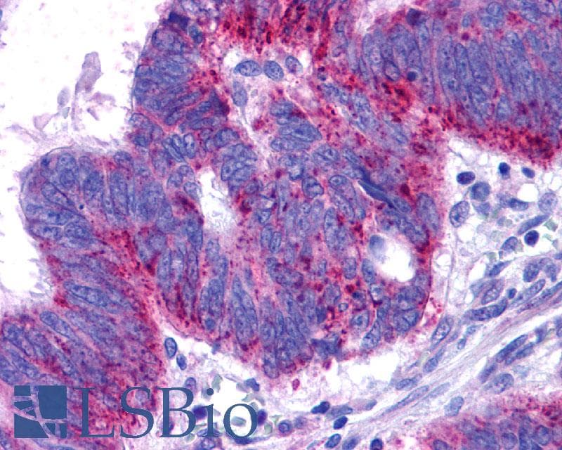 PathPlus™ EDNRB / Endothelin B Receptor Antibody (N-Terminus)