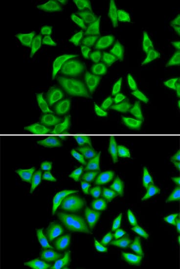 SNRPE Antibody
