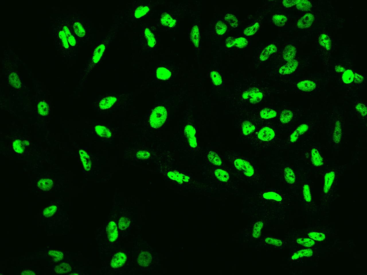 Cullin 4B / CUL4B Antibody