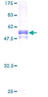 Human PIM1 / Pim-1 Protein (Recombinant GST)