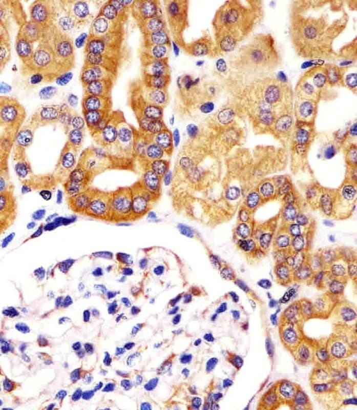 VAC14 / TRX Antibody (aa125-159)