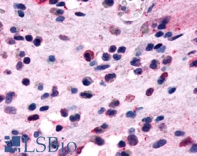 PathPlus™ GPR44 / CRTH2 Antibody (Extracellular Domain)