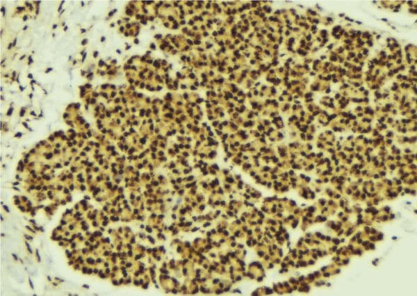 Polyclonal Rabbit anti-Human STAT2 Antibody (IHC, IF, WB)