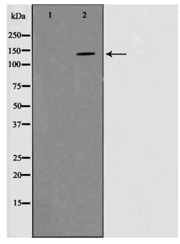 Polyclonal Rabbit anti-Human PTK2B / PYK2 Antibody (phospho-Tyr580, IHC, WB)