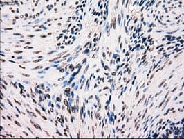 BRAF / B-Raf Antibody (clone OTI5A9)