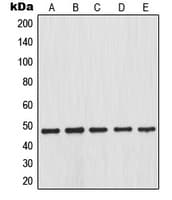 NFKBIB / IKB Beta / IKBB Antibody (phospho-Ser23)