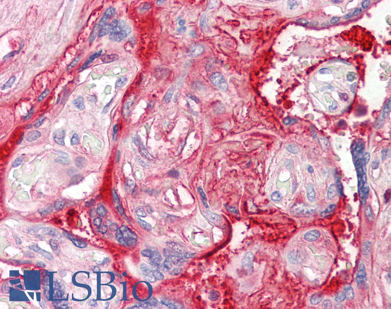 IHC-plus™ FN1 / Fibronectin Antibody (C-Terminus)