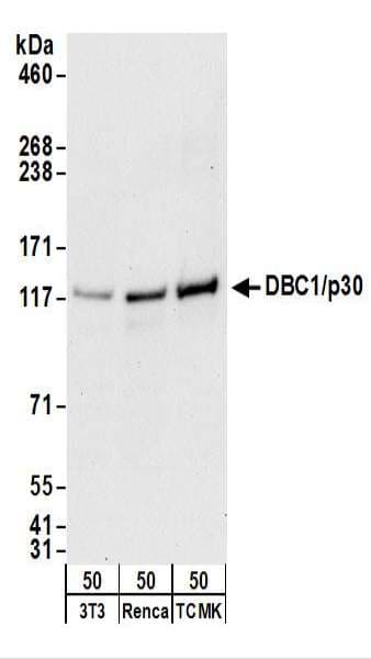 CCAR2 / KIAA1967 Antibody (aa873-923)