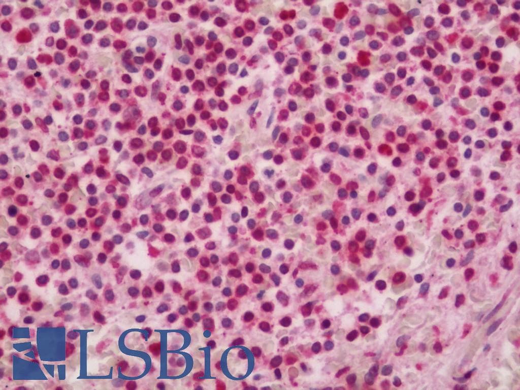 IHC-plus™ GBP2 Antibody (clone 5C8)