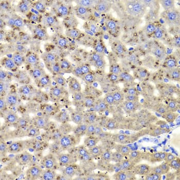 Polyclonal Rabbit anti-Human HSD17B13 Antibody (IHC, WB)
