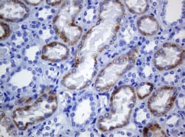 AMACR / P504S Antibody (clone OTI2A11, Carrier-free)