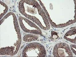 DPH2 Antibody (clone OTI2B12)