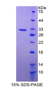 Human PTGS1 / COX-1 Protein (Recombinant His, N-Terminal)