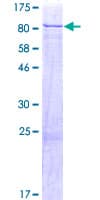 Human GRK6 Protein (Recombinant GST)