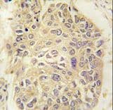FARSA Antibody (aa54-83)