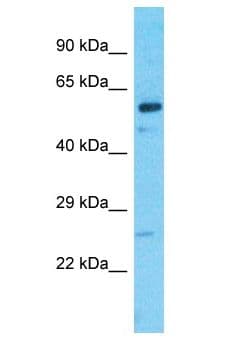 IQCC Antibody (aa472-521)