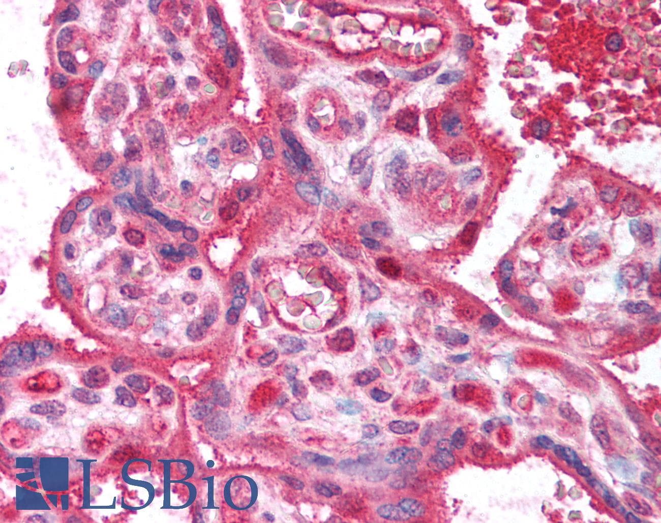 IHC-plus™ LPP3 / PPAP2B Antibody