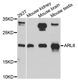 IHC-plus™ ARL6 Antibody