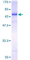 Human RADIL Protein (Recombinant GST)