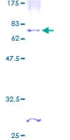 Human CHST4 / GlcNAc6ST2 Protein (Recombinant GST)