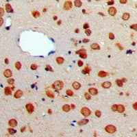 TNFSF13 / APRIL Antibody (Internal)