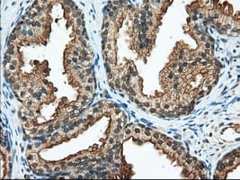 IHC-plus™ RANGAP1 Antibody (clone 1B4)