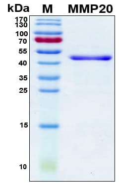 Human MMP20 Protein (Recombinant 6His, N-terminus)