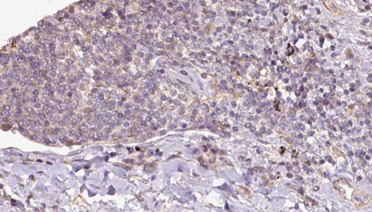 Polyclonal Rabbit anti-Human PRDX5 / Peroxiredoxin 5 Antibody (IHC, IF, WB)